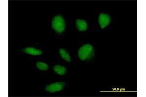 Immunofluorescence of purified MaxPab antibody to ZBTB39 on HeLa cell. (ZBTB39 抗体  (AA 1-712))