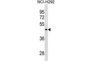 Western Blotting (WB) image for anti-RNA Binding Motif Protein, Y-Linked Family 1 Member A1 (RBMY1A1) antibody (ABIN2995181) (RBMY1A1 抗体)