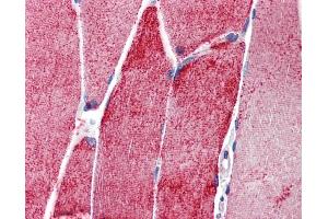 Immunohistochemistry (IHC) image for anti-Actinin, alpha 3 (ACTN3) (N-Term) antibody (ABIN2777061) (ACTN3 抗体  (N-Term))