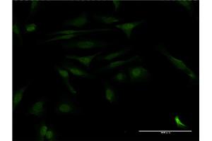 Immunofluorescence of monoclonal antibody to CALCOCO2 on HeLa cell. (CALCOCO2 抗体  (AA 347-446))