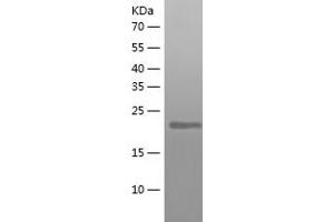 Western Blotting (WB) image for 1-Acylglycerol-3-Phosphate O-Acyltransferase 9 (AGPAT9) (AA 225-430) protein (His tag) (ABIN7121594) (AGPAT9 Protein (AA 225-430) (His tag))