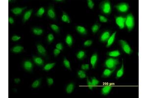 Immunofluorescence of monoclonal antibody to HIST1H3D on HeLa cell. (HIST1H3D 抗体  (AA 1-60))
