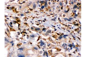 Immunohistochemistry (IHC) image for anti-Transporter 1, ATP-Binding Cassette, Sub-Family B (MDR/TAP) (TAP1) (AA 438-471), (Middle Region) antibody (ABIN3043943)