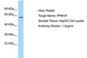 Image no. 1 for anti-Protein Phosphatase 1H (PP2C Domain Containing) (PPM1H) (AA 71-120) antibody (ABIN6750020) (PPM1H 抗体  (AA 71-120))