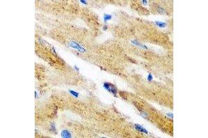 Immunohistochemical analysis of Kynureninase staining in mouse heart formalin fixed paraffin embedded tissue section. (KYNU 抗体)