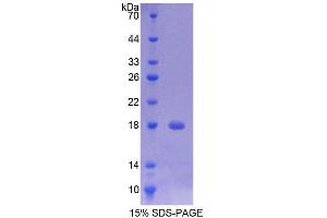 SDS-PAGE analysis of Rat TMEM27 Protein. (TMEM27 蛋白)