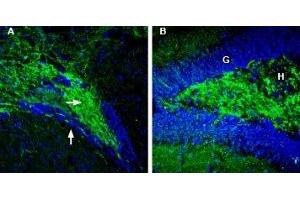 Expression of Synapsin-2 in mouse ventral striatum and rat hippocampus - Immunohistochemical staining of perfusion-fixed frozen mouse brain sections with Anti-Synapsin II (SYN2) Antibody (ABIN7043787, ABIN7044660 and ABIN7044661), (1:200), followed by goat-anti-rabbit-AlexaFluor-488 (green staining). (SYN2 抗体  (Domain G, Intracellular))