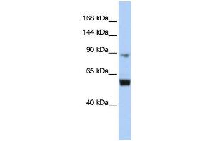 MCM10 antibody used at 1 ug/ml to detect target protein. (MCM10 抗体  (Middle Region))