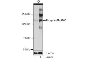 Western blot analysis of extracts of C6 cells, using Phospho-RB-S780 Rabbit mAb (ABIN7269936) at 1:1000 dilution. (Retinoblastoma 1 抗体  (pSer780))