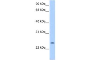 Western Blotting (WB) image for anti-PQ Loop Repeat Containing 1 (PQLC1) antibody (ABIN2463302) (PQLC1 抗体)