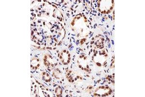 Immunohistochemical analysis of paraffin-embedded H. (PPARA 抗体  (AA 1-468))
