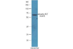 Mouse liver lysates probed with Rabbit Anti-AKT(Ser473) Polyclonal Antibody, Unconjugated  at 1: 5000 for 90min at 37˚C. (AKT 1/2/3 抗体  (pSer473))