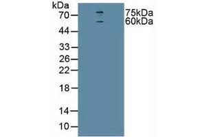 Detection of CHRNa4 in Human U-87MG Cells using Polyclonal Antibody to Cholinergic Receptor, Nicotinic, Alpha 4 (CHRNa4)