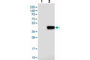 Western blot analysis of Lane 1: Negative control (vector only transfected HEK293T lysate), Lane 2: Over-expression Lysate (Co-expressed with a C-terminal myc-DDK tag (~3. (PLEKHF1 抗体)
