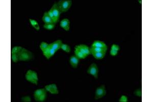 Immunofluorescence staining of HepG2 cells with ABIN7172879 at 1:266, counter-stained with DAPI. (TRPV2 抗体  (AA 1-117))