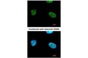 ICC/IF Image Immunofluorescence analysis of paraformaldehyde-fixed HeLa, using WTAP, antibody at 1:500 dilution. (WTAP 抗体  (Center))