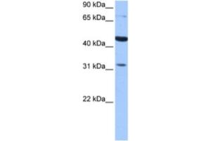 Western Blotting (WB) image for anti-Tetra-Peptide Repeat Homeobox-Like (TPRXL) antibody (ABIN2463460) (TPRXL 抗体)
