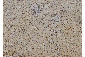 ABIN6263615 and ABIN6269188 at 1/100 staining Rat kidney tissue by IHC-P.