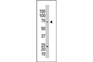 The CAPRIN1 polyclonal antibody  is used in Western blot to detect CAPRIN1 in HL-60 cell lysate . (Caprin-1 抗体  (AA 625-654))