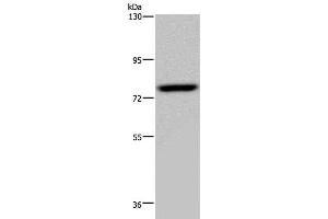 Western Blot analysis of PC3 cell using NR4A1 Polyclonal Antibody at dilution of 1:200 (NR4A1 抗体)