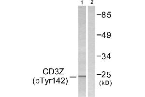 Western blot analysis of extracts from Jurkat cells, treated with UV (15mins), using CD3 ζ (Phospho-Tyr142) antibody. (CD247 抗体  (pTyr142))