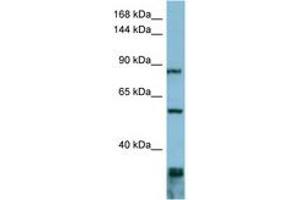 Image no. 1 for anti-Epidermal Growth Factor Receptor Pathway Substrate 8 (EPS8) (AA 647-696) antibody (ABIN6741834)
