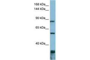 Image no. 1 for anti-Epidermal Growth Factor Receptor Pathway Substrate 8 (EPS8) (AA 647-696) antibody (ABIN6741834) (EPS8 抗体  (AA 647-696))