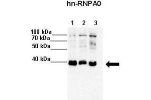 Lanes :  Lane 1: 20ug HeLa S3 lysate Lane 2: 20ug MCF7 lysate Lane 3: 20ug K562 lysate   Primary Antibody Dilution :   1:4000    Secondary Antibody :  Anti-rabbit-HRP   Secondary Antibody Dilution :   1:5000   Gene Name :  HNRPA0   Submitted by :  Anonymous (HNRNPA0 抗体  (Middle Region))