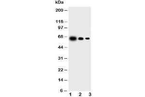 Western blot testing of IL23 p19 antibody and Lane 1:  recombinant mouse protein 10ng;  2: 5ng;  3: 2. (IL23A 抗体  (N-Term))