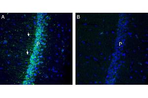 Expression of KCa2. (KCNN1 抗体  (Intracellular))