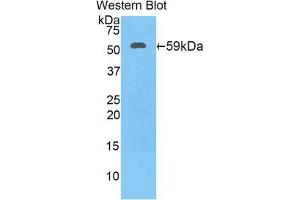 Western blot analysis of the recombinant protein. (HSD17B12 抗体  (AA 11-291))