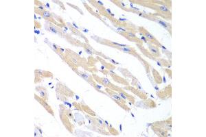 Immunohistochemistry of paraffin-embedded mouse heart using TRIM21 antibody at dilution of 1:100 (x40 lens). (TRIM21 抗体)
