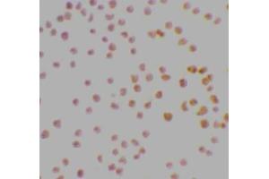 Immunocytochemical staining of MOLT4 cells using DRAK1 antibody at 2μg/ml. (STK17A 抗体  (AA 5-19))