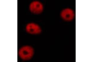 F7376 staining HEPG2 cells by ICC/IF. (DNMT1 抗体  (Internal Region))