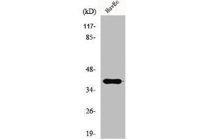 Western Blot analysis of HuvEc cells using Gads Polyclonal Antibody (GRAP2 抗体  (Internal Region))