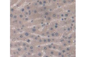 Immunohistochemistry (IHC) image for anti-Nitric Oxide Synthase 2, Inducible (NOS2) (AA 530-693) antibody (ABIN5014016)