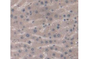 Used in DAB staining on fromalin fixed paraffin- embedded Kidney tissue (NOS2 抗体  (AA 530-693))