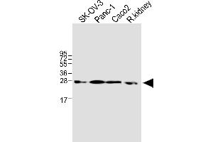 All lanes : Anti-TMEM97 Antibody (N-term) at 1:1000 dilution Lane 1: SK-OV-3 whole cell lysate Lane 2: Panc-1 whole cell lysate Lane 3: Caco2 whole cell lysate Lane 4: rat kidney lysate Lysates/proteins at 20 μg per lane. (TMEM97 抗体  (N-Term))