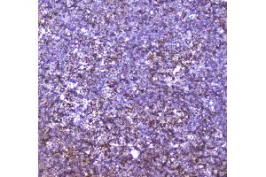 IHC analysis of CBFb using anti-CBFb antibody .