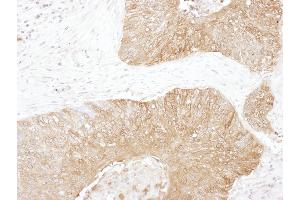 Immunohistochemistry (IHC) image for anti-Glucose-6-Phosphate Isomerase (GPI) (AA 1-50) antibody (ABIN7454562)