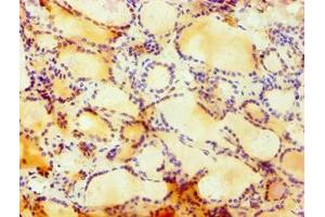 Immunohistochemistry of paraffin-embedded human thyroid tissue using ABIN7148757 at dilution of 1:100 (Cullin 4B 抗体  (AA 1-200))