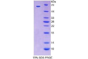 SDS-PAGE analysis of Human CDX2 Protein. (CDX2 蛋白)