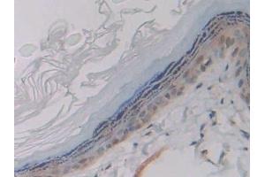 Immunohistochemistry (IHC) image for anti-Glycoprotein IX (Platelet) (GP9) (AA 1-189) antibody (ABIN7442297)