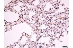 Formalin-fixed and paraffin embedded rat lung labeled with Anti-Endothelial lipase Polyclonal Antibody, Unconjugated  at 1:200 followed by conjugation to the secondary antibody and DAB staining. (LIPG 抗体  (AA 301-400))