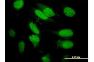 Immunofluorescence of purified MaxPab antibody to SEPT2 on HeLa cell. (Septin 2 抗体  (AA 1-361))