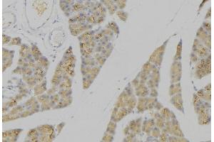 Immunohistochemistry (IHC) image for anti-Phospholipase A2, Group IIA (Platelets, Synovial Fluid) (PLA2G2A) (Internal Region) antibody (ABIN6264274)