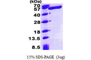 SDS-PAGE (SDS) image for Aldehyde Dehydrogenase 3 Family, Member A1 (ALDH3A1) (AA 1-453) (Active) protein (His tag) (ABIN667760)