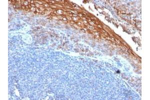 Image no. 1 for anti-Melanoma Cell Adhesion Molecule (MCAM) antibody (ABIN6153528) (MCAM 抗体)