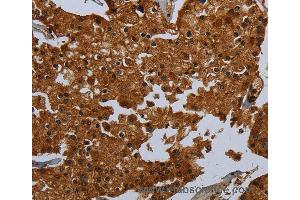 Immunohistochemistry of Human brain  using ENTPD7 Polyclonal Antibody at dilution of 1:60 (ENTPD7 抗体)