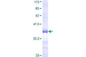 RFWD2 Protein (AA 632-731) (GST tag)